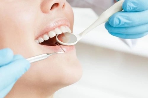 Endodonție Ploiești